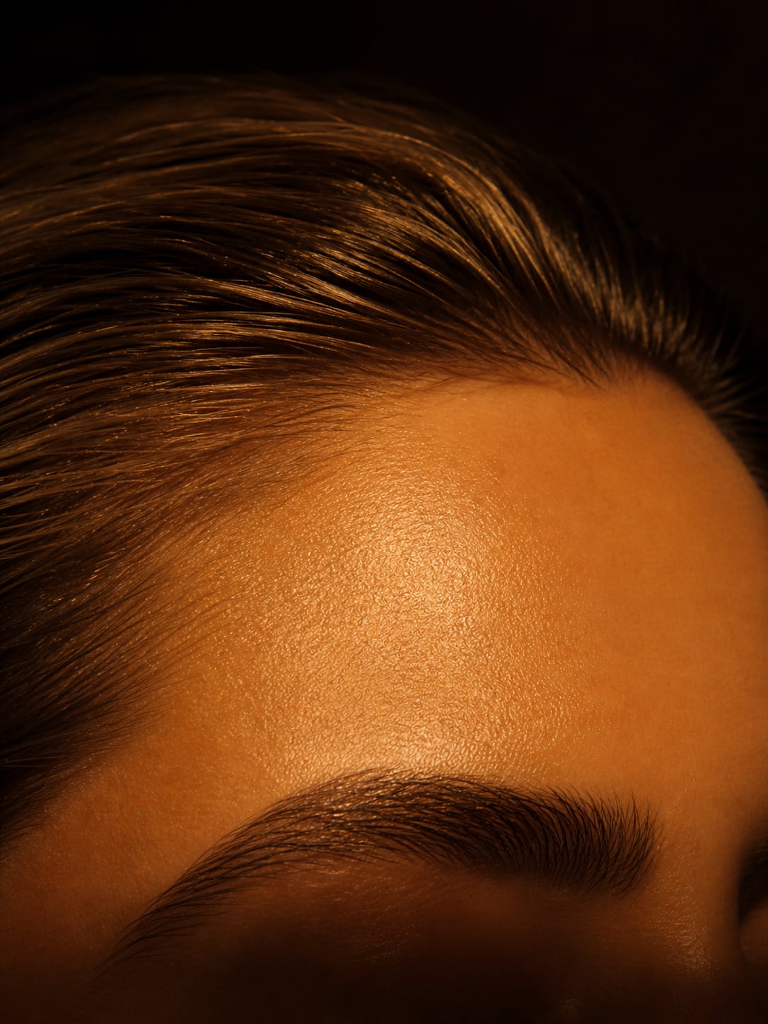 Botox na Clínica Plastiquè no Tatuapé